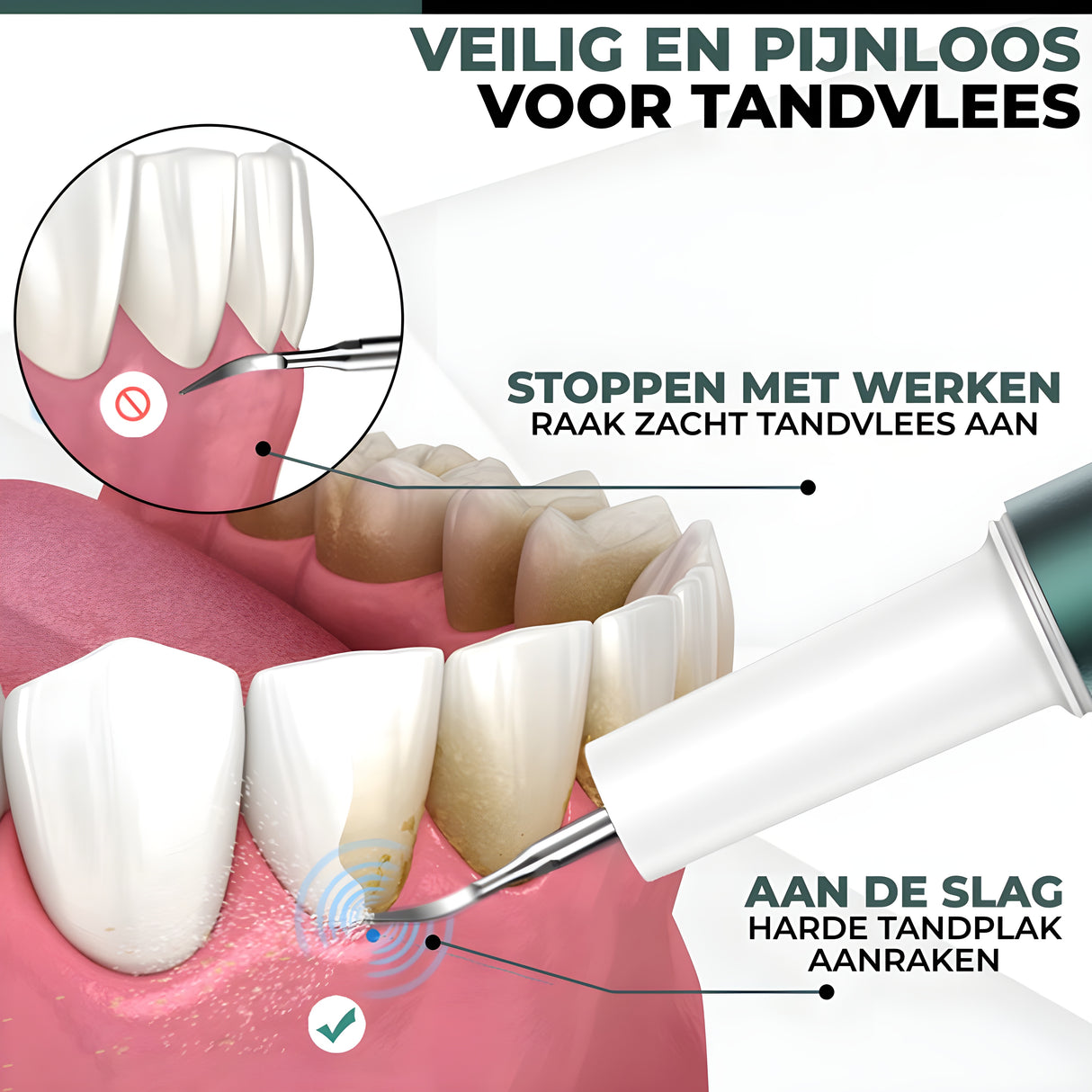 Waterflosser & Elektrische Tandsteenverwijderaar Bundel